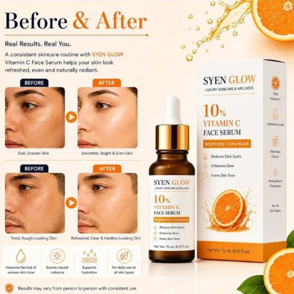 Syenglow 10% Vitamin C Face Serum with Niacinamide & Kojic Acid – 30 mL