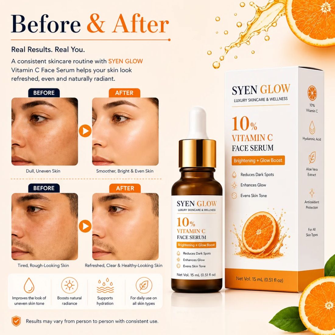 Syenglow 10% Vitamin C Face Serum with Niacinamide & Kojic Acid – 15 mL